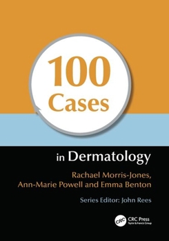 Paperback 100 Cases in Dermatology Book