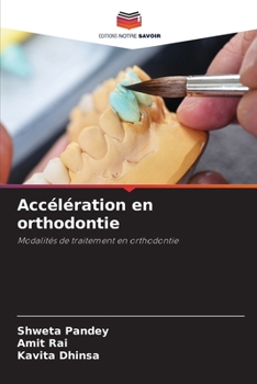 Paperback Accélération en orthodontie [French] Book