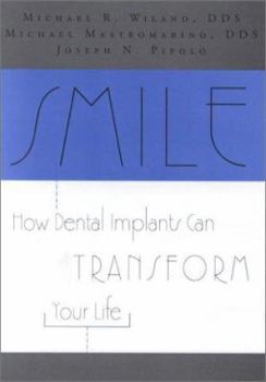 Paperback Smile How Dental Implants Book