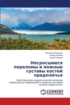 Paperback Несросшиеся переломы и л [Russian] Book