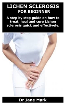 Paperback Lichen Sclerosis for Beginner: A step by step guide on how to treat, heal and cure Lichen sclerosis quick and effectively. Book