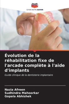 Paperback Évolution de la réhabilitation fixe de l'arcade complète à l'aide d'implants [French] Book