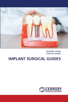 Paperback Implant Surgical Guides Book