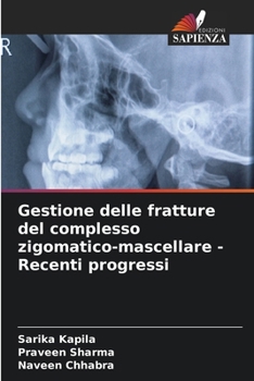 Paperback Gestione delle fratture del complesso zigomatico-mascellare - Recenti progressi [Italian] Book