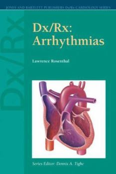 Paperback Dx/Rx: Arrhythmias: . (Dx/Rx Cardiology Series) Book