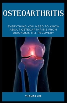 Paperback Osteoarthritis: Everything You Need to Know about Osteoarthritis from Diagnosis Till Recovery Book