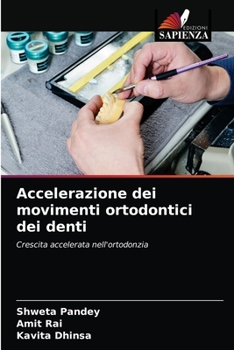 Paperback Accelerazione dei movimenti ortodontici dei denti [Italian] Book