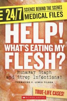 Paperback Help! Whats Eating My Flesh?: Runaway Staph and Strep Infections! Book