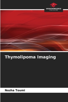 Paperback Thymolipoma Imaging Book