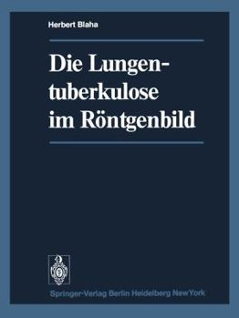 Paperback Die Lungentuberkulose Im Röntgenbild [German] Book