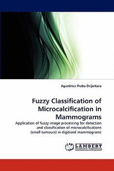 Paperback Fuzzy Classification of Microcalcification in Mammograms Book