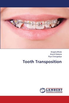 Tooth Transposition