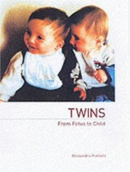 Paperback Twins - From Fetus to Child Book