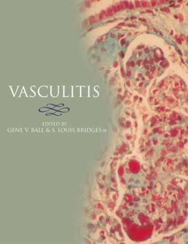 Hardcover Vasculitis Book