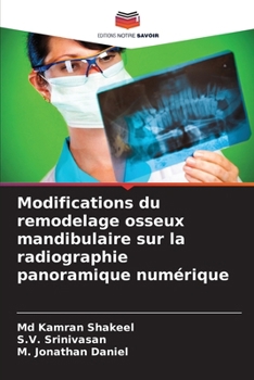Modifications du remodelage osseux mandibulaire sur la radiographie panoramique numérique (French Edition)