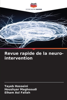 Paperback Revue rapide de la neuro-intervention [French] Book