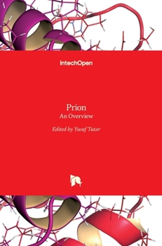 Hardcover Prion: An Overview Book