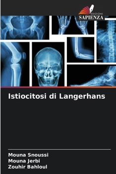 Paperback Istiocitosi di Langerhans [Italian] Book