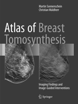 Paperback Atlas of Breast Tomosynthesis: Imaging Findings and Image-Guided Interventions Book