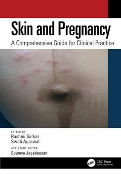 Skin and Pregnancy: A Practical Guide for Health Professionals