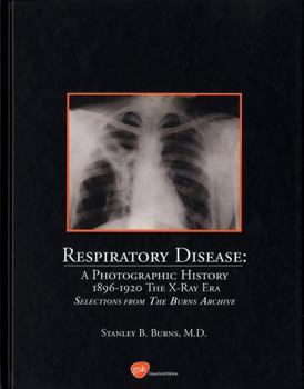 Hardcover Respiratory Disease a Photographic History 1896-1920 the X-Ray Era by Stanley B. Md Burns (2003) Hardcover Book