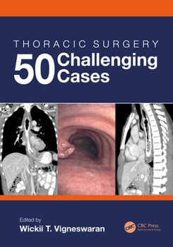 Paperback Thoracic Surgery: 50 Challenging Cases Book
