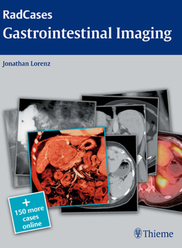 Paperback Radcases Gastrointestinal Imaging Book