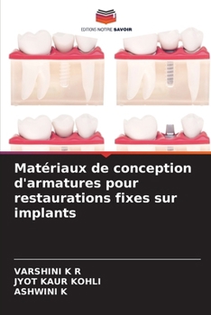 Paperback Matériaux de conception d'armatures pour restaurations fixes sur implants [French] Book