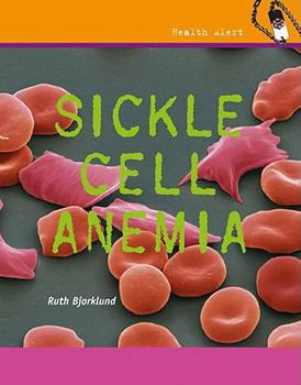 Sickle Cell Anemia - Book  of the Health Alert
