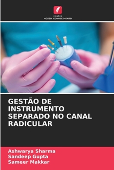 Paperback Gestão de Instrumento Separado No Canal Radicular [Portuguese] Book