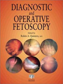 Hardcover Diagnostic and Operative Fetoscopy Book