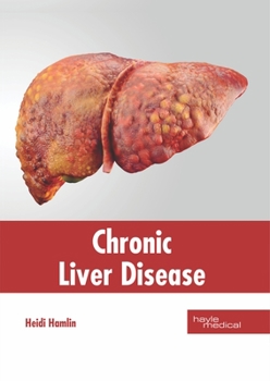 Hardcover Chronic Liver Disease Book
