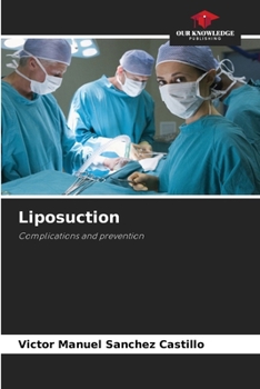 Paperback Liposuction Book