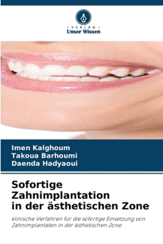 Paperback Sofortige Zahnimplantation in der ästhetischen Zone [German] Book