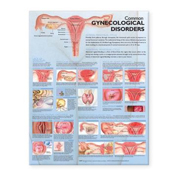 Wall Chart Common Gynecological Disorders Anatomical Chart Book