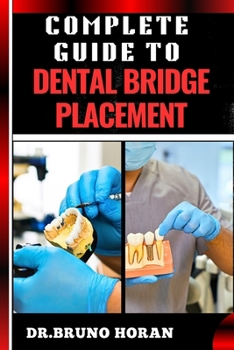 COMPLETE GUIDE TO DENTAL BRIDGE PLACEMENT: Comprehensive Manual To Restoring Smiles, Improving Oral Health, And Ensuring Long Lasting Tooth Solutions