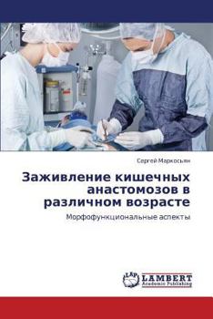 Paperback Zazhivlenie Kishechnykh Anastomozov V Razlichnom Vozraste [Russian] Book