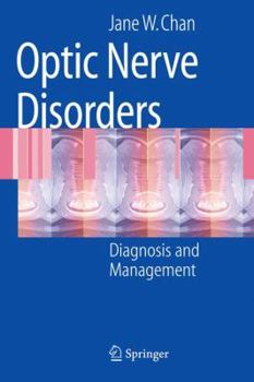 Paperback Optic Nerve Disorders: Diagnosis and Management Book