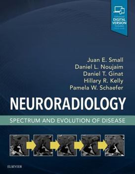 Hardcover Neuroradiology: Spectrum and Evolution of Disease Book