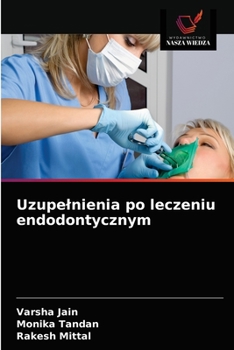 Paperback Uzupelnienia po leczeniu endodontycznym [Polish] Book