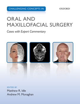 Paperback Challenging Concepts in Oral and Maxillofacial Surgery: Cases with Expert Commentary Book