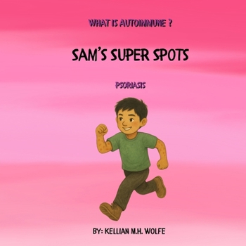 Sam’s Super Spots: Psoriasis (What is Autoimmune?)