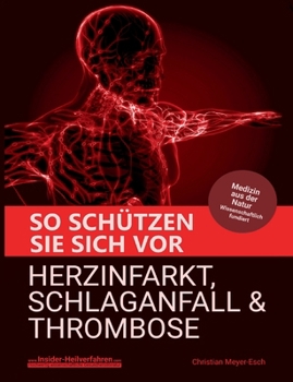 Paperback So schützen Sie sich vor Herzinfarkt, Schlaganfall und Thrombose [German] Book