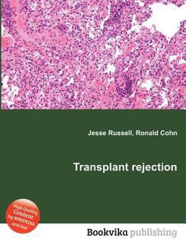 Paperback Transplant Rejection Book