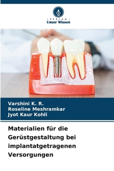 Paperback Materialien für die Gerüstgestaltung bei implantatgetragenen Versorgungen [German] Book