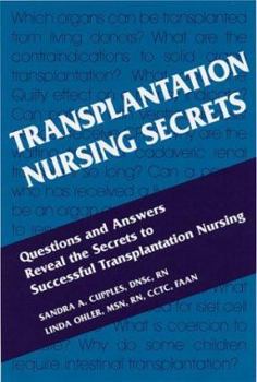 Paperback Transplantation Nursing Secrets Book