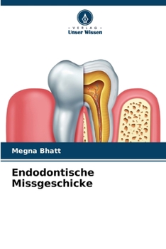 Paperback Endodontische Missgeschicke [German] Book