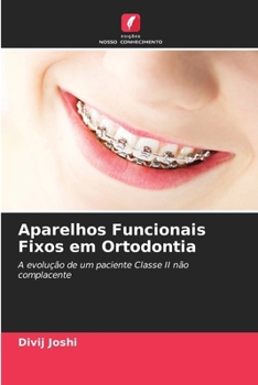 Paperback Aparelhos Funcionais Fixos em Ortodontia [Portuguese] Book