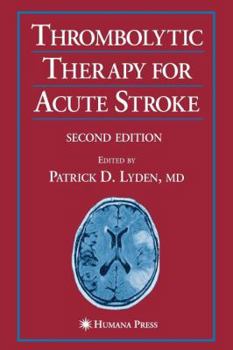 Paperback Thrombolytic Therapy for Acute Stroke Book