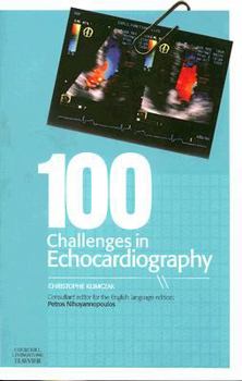 Paperback 100 Challenges in Echocardiography Book